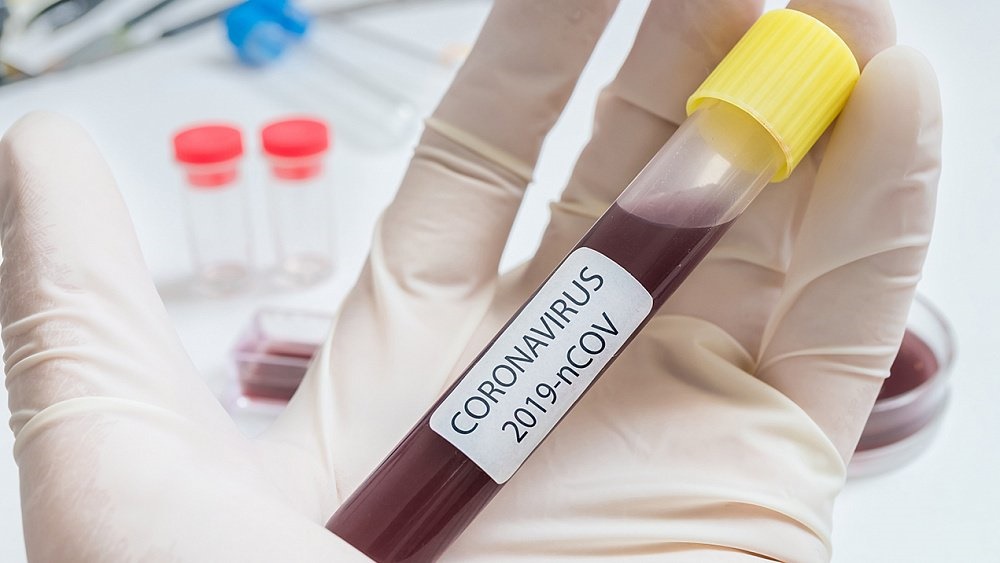 До пятидесяти возросло число заболевших коронавирусом в Челябинской области