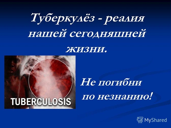 Случаи туберкулёза  в Октябрьском районе