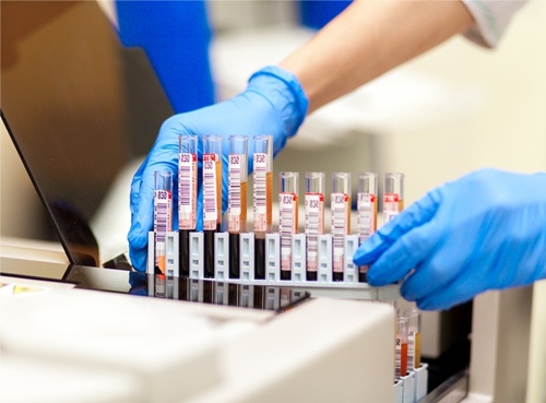 В южноуральских больницах появятся новые анализаторы крови